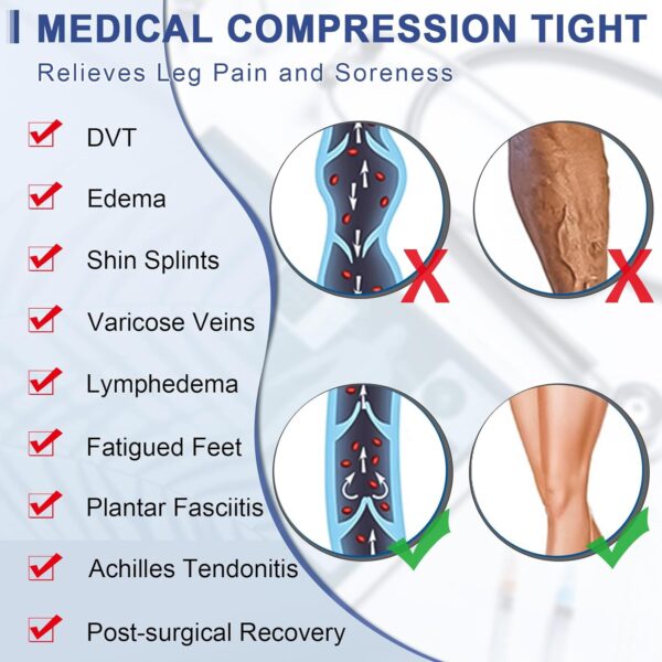 Beister Medical Compression Pantyhose for Women & Men, Opaque Closed Toe 20-30mmHg Graduated Support Tight - Image 7