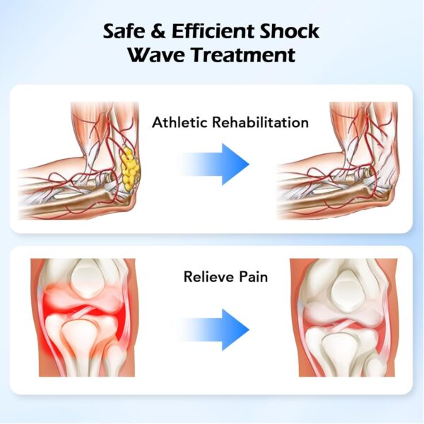 Shockwave Therapy Machine, Extracorporeal Shock Wave Therapy Device for Pain Relief, ESWT Machine for Muscle, Back, Joint, Elbow, Shock Wave Therapy for Home Use, Gym, Rehabilitation - Image 7