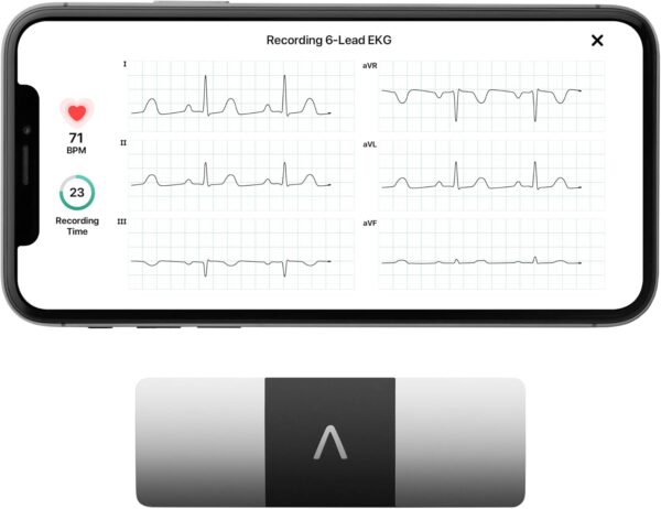 KardiaMobile 6-Lead Personal EKG Monitor – Six Views of The Heart – Detects AFib and Irregular Arrhythmias – Instant Results in 30 Seconds – Works with Most Smartphones - FSA/HSA Eligible - Image 2